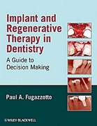 Implant and Regenerative Therapy in Dentistry: a Guide to Decision Making