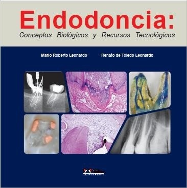 ENDODONCIA: CONCEPTOS BIOLOGICOS Y RECURSOS TECNOLOGICOS - Leonardo