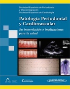  Patologia Periodontal y Cardiovascular - De Teresa Galvan / Blas Noguerol