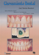 Clareamiento Dental -L.Narciso Baratieri