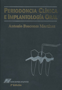 Periodoncia clínica e Implantología oral - A. Bascones