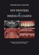 New frontiers in immediate Loading -  Sabattini