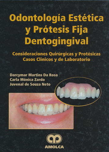 ODONTOLOGIA ESTETICA Y PROTESIS FIJA DENTOGINGIVAL - Martins Da Rosa / Zardo / de Souza