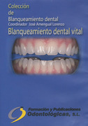 Colección de Blanqueamiento dental: Blanqueamiento dental vital - J. Amengual
