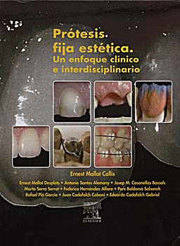 PROTESIS FIJA ESTETICA: UN ENFOQUE CLINICO E INTERDISCIPLINARIO - Mallat