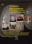 PROTESIS FIJA ESTETICA: UN ENFOQUE CLINICO E INTERDISCIPLINARIO - Mallat