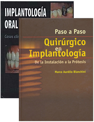 Paso a Paso Quirúrgico en Implantología + Implantología Oral - Bianchini / Pedrola