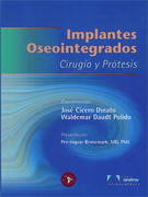 Implantes Oseointegrados: Cirugia y Protesis - Cicero Dinato