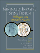 Minimally Invasive Spine Fusion: Techniques and Operative Nuances - Perez.Cruet / Beisse / Pimienta / Kim