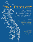 Spinal Deformity: A Guide to Surgical Planning and Management - Mummanemi / Lenke