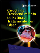 Cirugia de Desprendimiento de Retina y Tratamiento de Laser - Samuel Boyd
