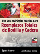 Una Guía Quirúrgica Práctica para Reemplazos Totales de Rodilla y  Cadera - Kumar Mehta