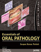 Essentials of Oral Pathology - Kumar
