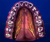 Management of implant complications during healing and before final prosthetic therapy - Jovanovic