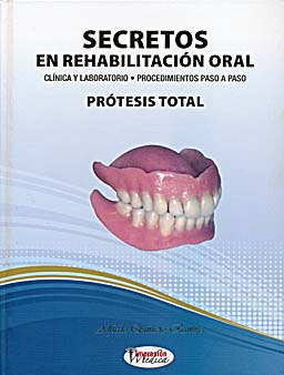 Secretos en Rehabilitación Oral. Clínica y Laboratorio. Procedimientos Paso a Paso. Prótesis Total - Quintero