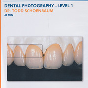 Dental Photography - Level 1 - Schoenbaum