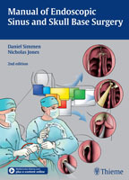 Manual of Endoscopic Sinus and Skull Base Surgery - Simmen / Jones