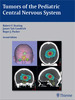 Tumors of the Pediatric Central Nervous System - Keating / Goodrich / Packer