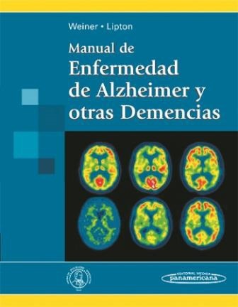 Manual de Enfermedad de Alzheimer y otras Demencias - Myron F. Weiner / Anne M Lipton