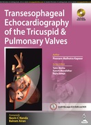 Transesophageal Echocardiography of the Tricuspid & Pulmonary Valves - Malhotra Kapoor