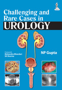Challenging and Rare Cases in Urology - NP Gupta