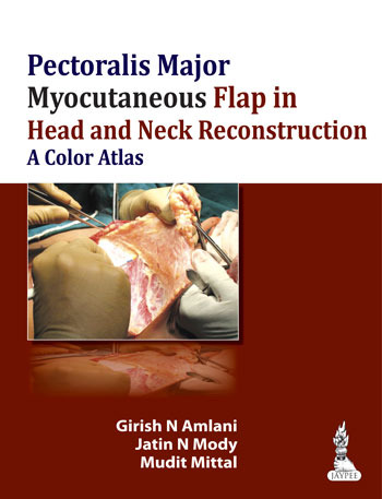 Pectoralis Major Myocutaneous Flap in Head and Neck Reconstruction - Amlani / Mody / Mittal