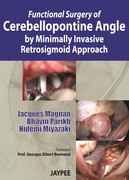 Functional Surgery of Cerebellopontine Angle by Minimally Invasive Retrosigmoid Approach - Magnan / Parikh / Miyazaki