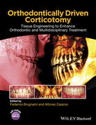 Orthodontically Driven Corticotomy: Tissue Engineering to Enhance Orthodontic and Multidisciplinary Treatment - Brugnami / Caiazzo