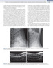 Diagnóstico, Manejo y Tratamiento del Dolor Discogénico. Volumen 3 - Kapural /Kim