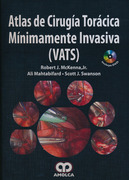 Atlas de cirugía torácica minimamente invasiva (VATS) - McKenna / Mahtabifard
