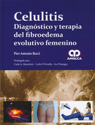 Celulitis. Diagnóstico y terapia del fibroedema evolutivo femenino - Bacci