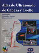 Atlas de ultrasonido de cabeza y cuello + DVD - Iro / Bozzato / Zenk