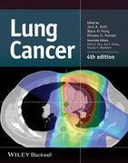 Lung Cancer, 4th Edition - A. Roth / Ki Hong / U. Komaki