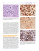 Manual de Oncología Médica MD Anderson 2Vols. – Kantarjian / Wolff / Koller