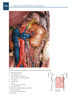 Atlas de Cirugía de las Arterias 2 Vols. - Cavallaro / V. Sterpetti / Barberin / di Marzo