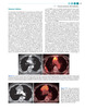 Imágenes Oncológicas: Un enfoque multidisciplinario - M. Silverman