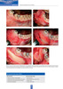 TACTICAS Y TECNICAS EN CIRUGIA ORAL – Tercera edición - Chiapasco