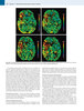 ATLAS DE NEUROLOGIA CLINICA - PERKIN /MILLER /LANE /PATEL /HOCHBERG