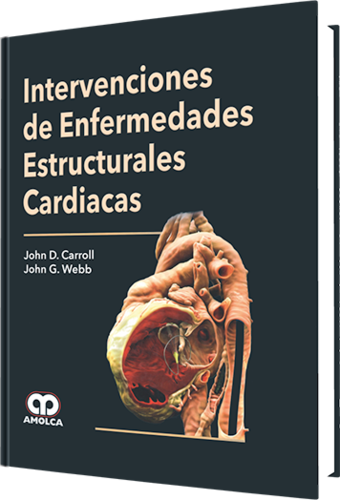 INTERVENCIONES DE ENFERMEDADES ESTRUCTURALES CARDIACAS - Carroll / Webb