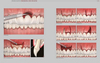 EVIDENCE-BASED PERIODONTAL AND PERI-IMPLANT PLASTIC SURGERY. A CLINICAL ROADMAP FROM FUNCTION TO AESTHETICS - Chambrone