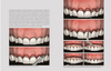 EVIDENCE-BASED PERIODONTAL AND PERI-IMPLANT PLASTIC SURGERY. A CLINICAL ROADMAP FROM FUNCTION TO AESTHETICS - Chambrone