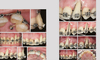 EVIDENCE-BASED PERIODONTAL AND PERI-IMPLANT PLASTIC SURGERY. A CLINICAL ROADMAP FROM FUNCTION TO AESTHETICS - Chambrone