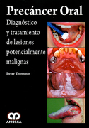 PRECANCER ORAL DIAGNOSTICO Y TRATAMIENTO DE LESIONES POTENCIALMENTE MALIGNAS - Thomson