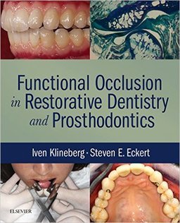 FUNCTIONAL OCCLUSION IN RESTORATIVE DENTISTRY AND PROSTHODONTICS - Klineberg