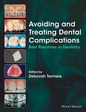 AVOIDING AND TREATING DENTAL COMPLICATIONS - Termeie