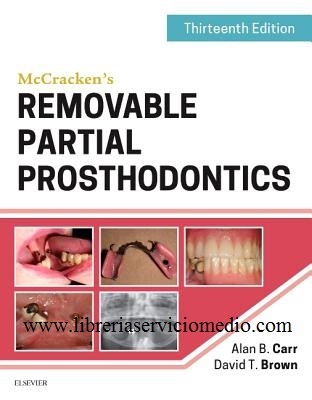 McCracken's REMOVABLE PARTIAL PROSTHODONTICS 13ED - Carr