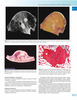 PATOLOGIA ORTOPEDICA PRACTICA - Deyrup