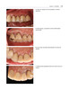 ATLAS DE ODONTOLOGIA ESTETICA INTEGRAL - Jimenez