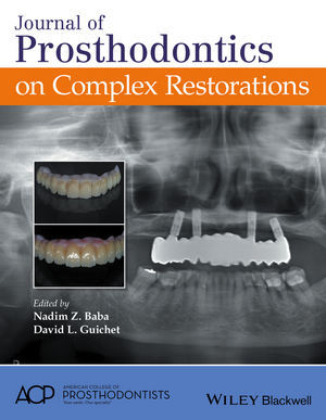 JOURNAL OF PROSTHODONTICS ON COMPLEX RESTORATIONS - Baba