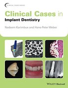 CLINICAL CASES IN IMPLANT DENTISTRY - Nadeem Karimbux